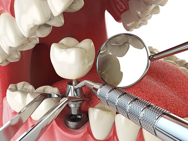 Emergency Gum Pain Relief in HI